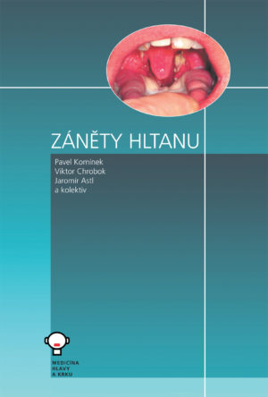 Záněty hltanu - výprodej