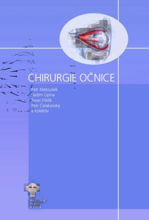 Chirurgie očnice