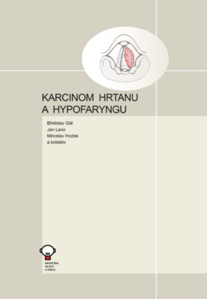 Karcinom hrtanu a hypofaryngu